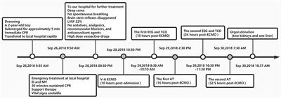 The Challenges of Apnea Tests in the Determination of Brain Death in Child Patient on Extracorporeal Membrane Oxygenation